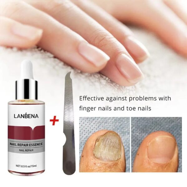 Nail Repair Anti-Infection Serum - 15ml - Image 4